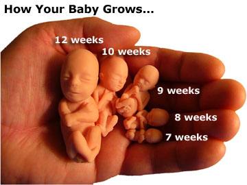Teen Abortions Facts 83