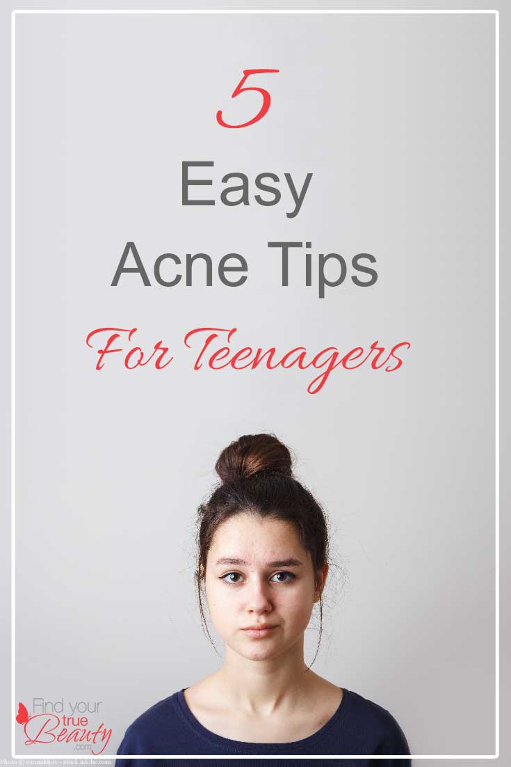 5 Easy Acne Tips for Teenagers